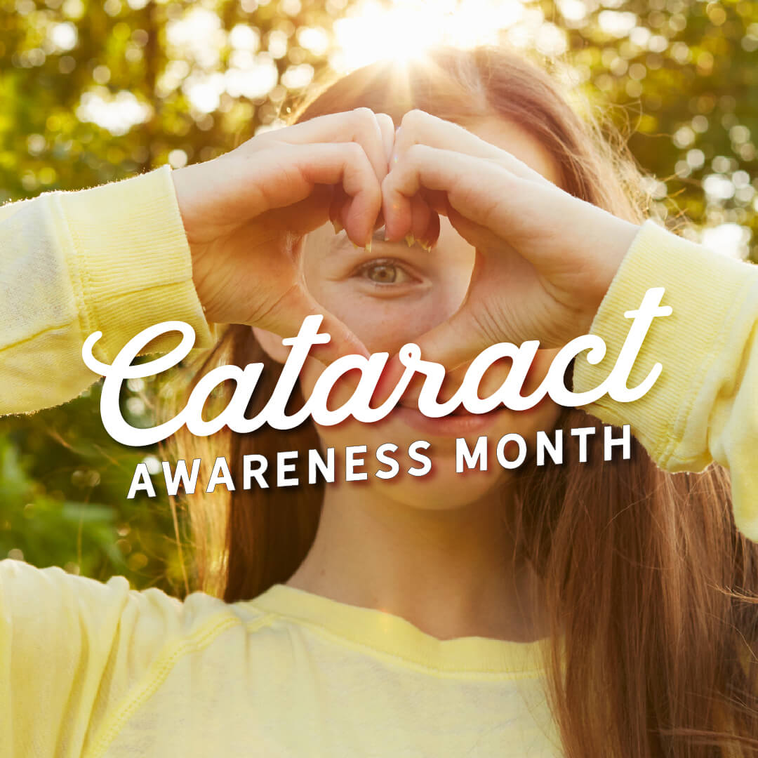 cataracts